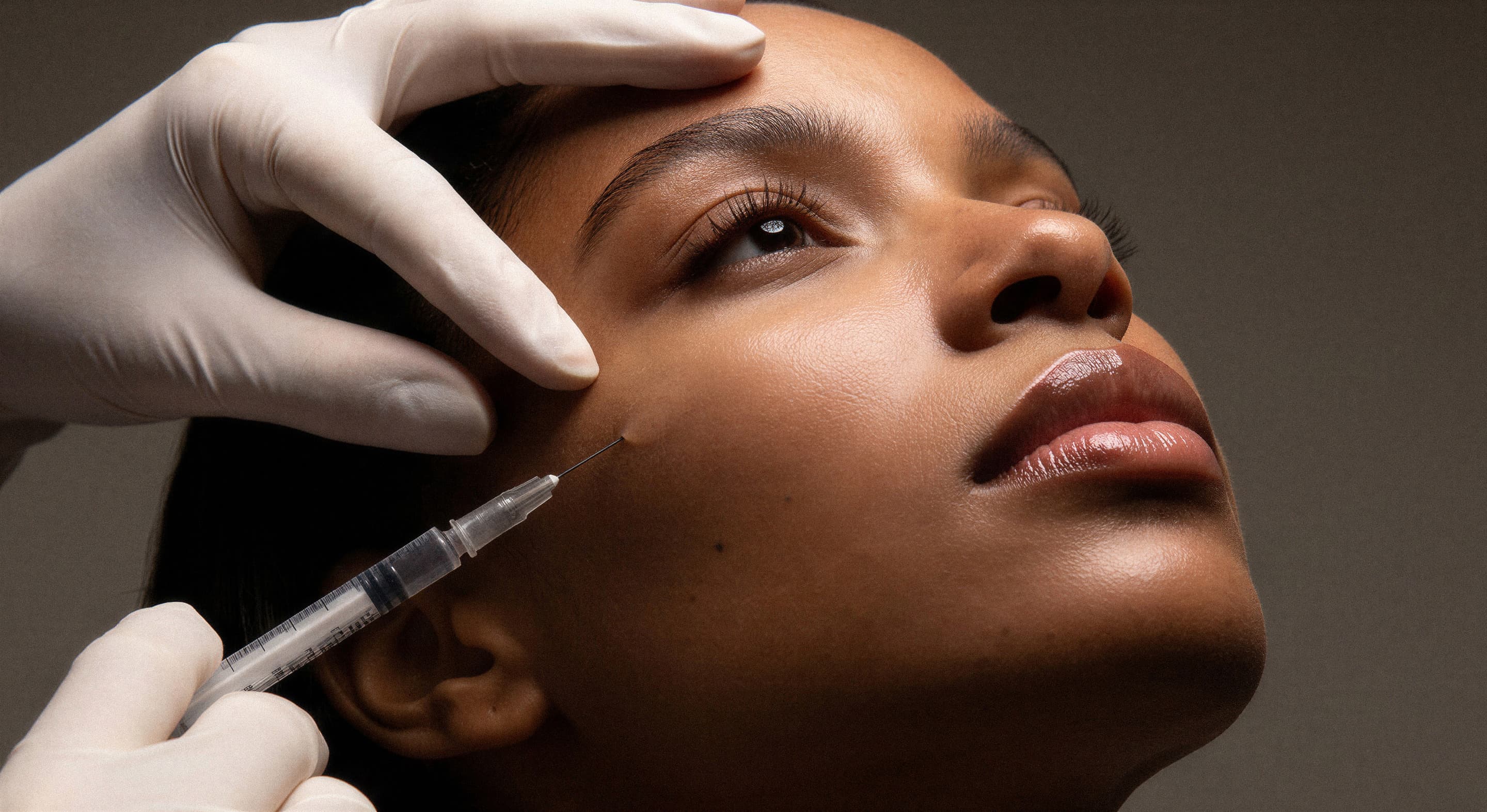 Thin lips and lost lip definition — treated at Wellness 90210 Beverly Hills