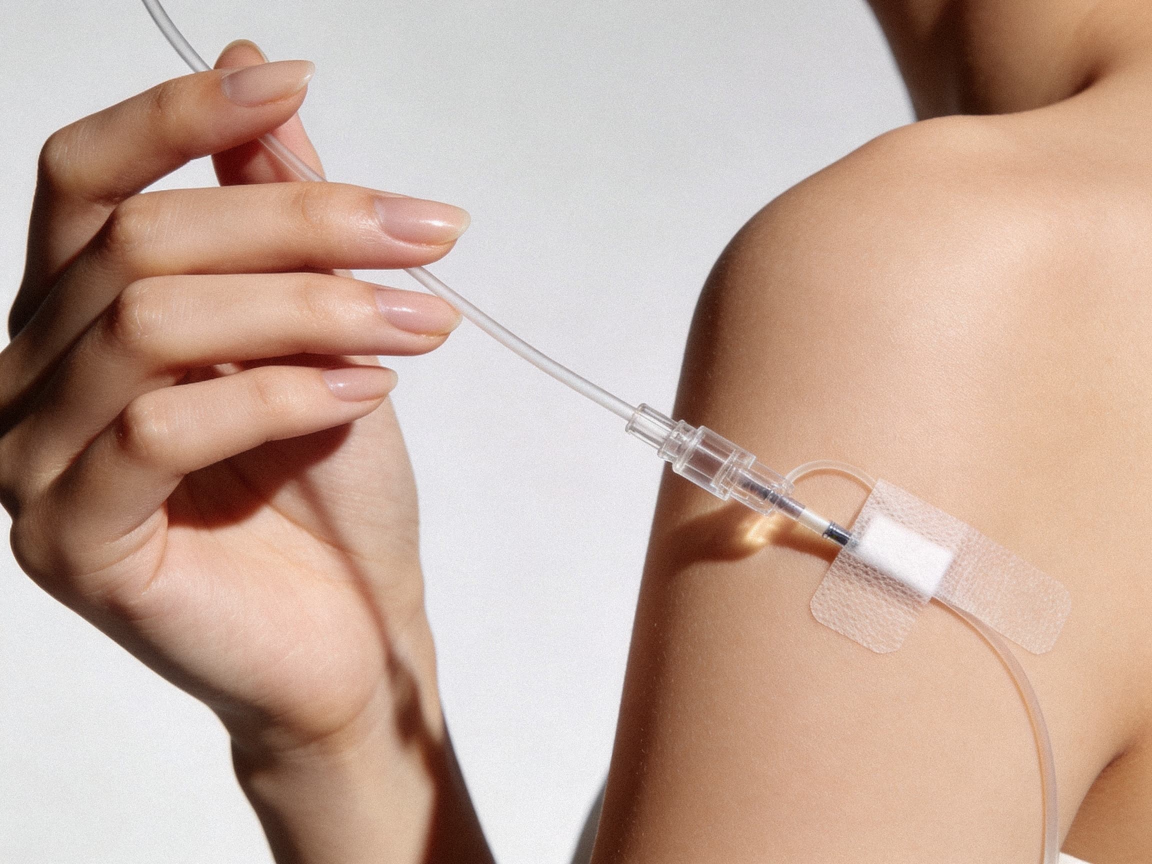 Dehydration, hangover and recovery — treated at Wellness 90210 Beverly Hills
